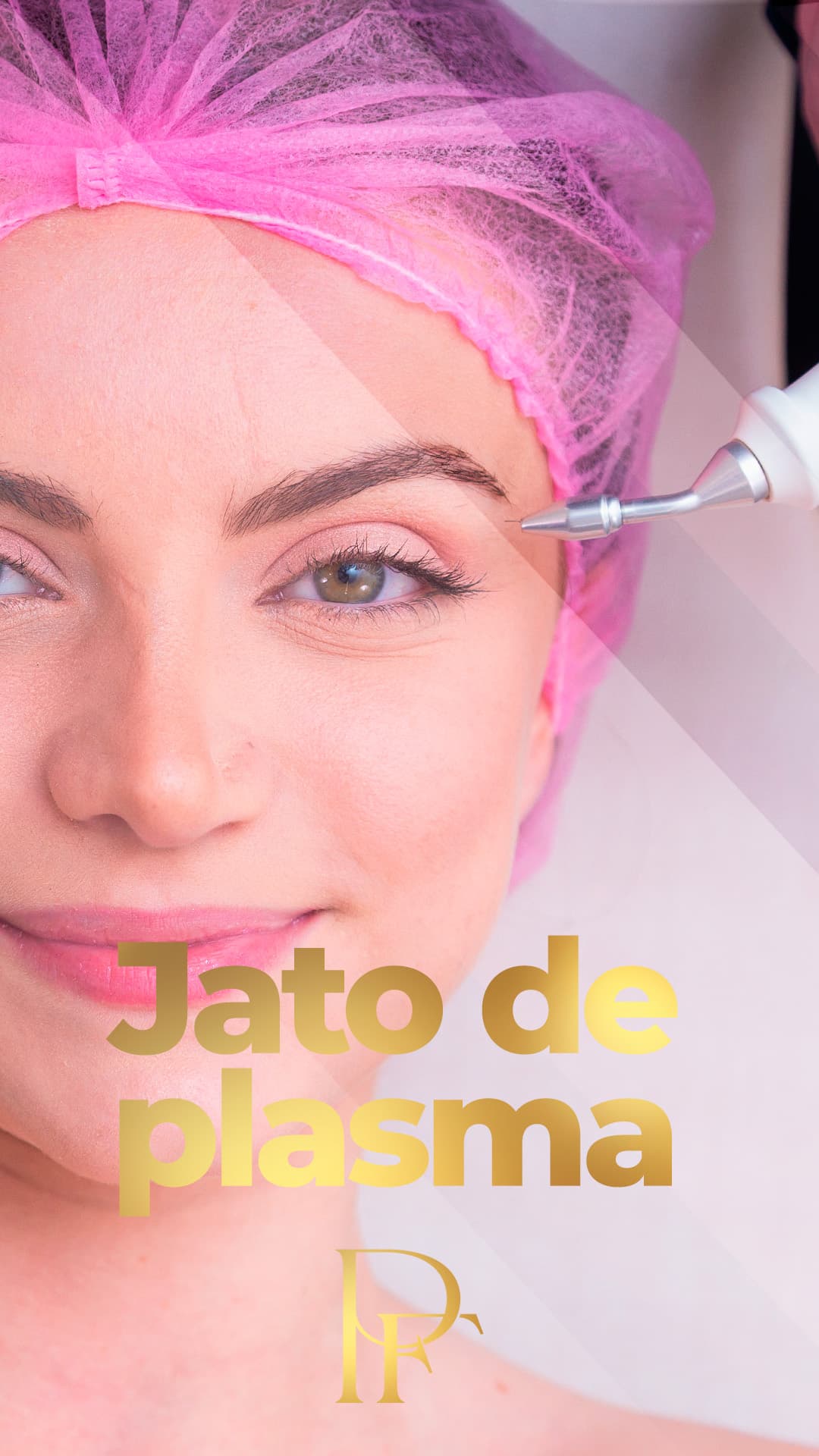 Jato de Plasma